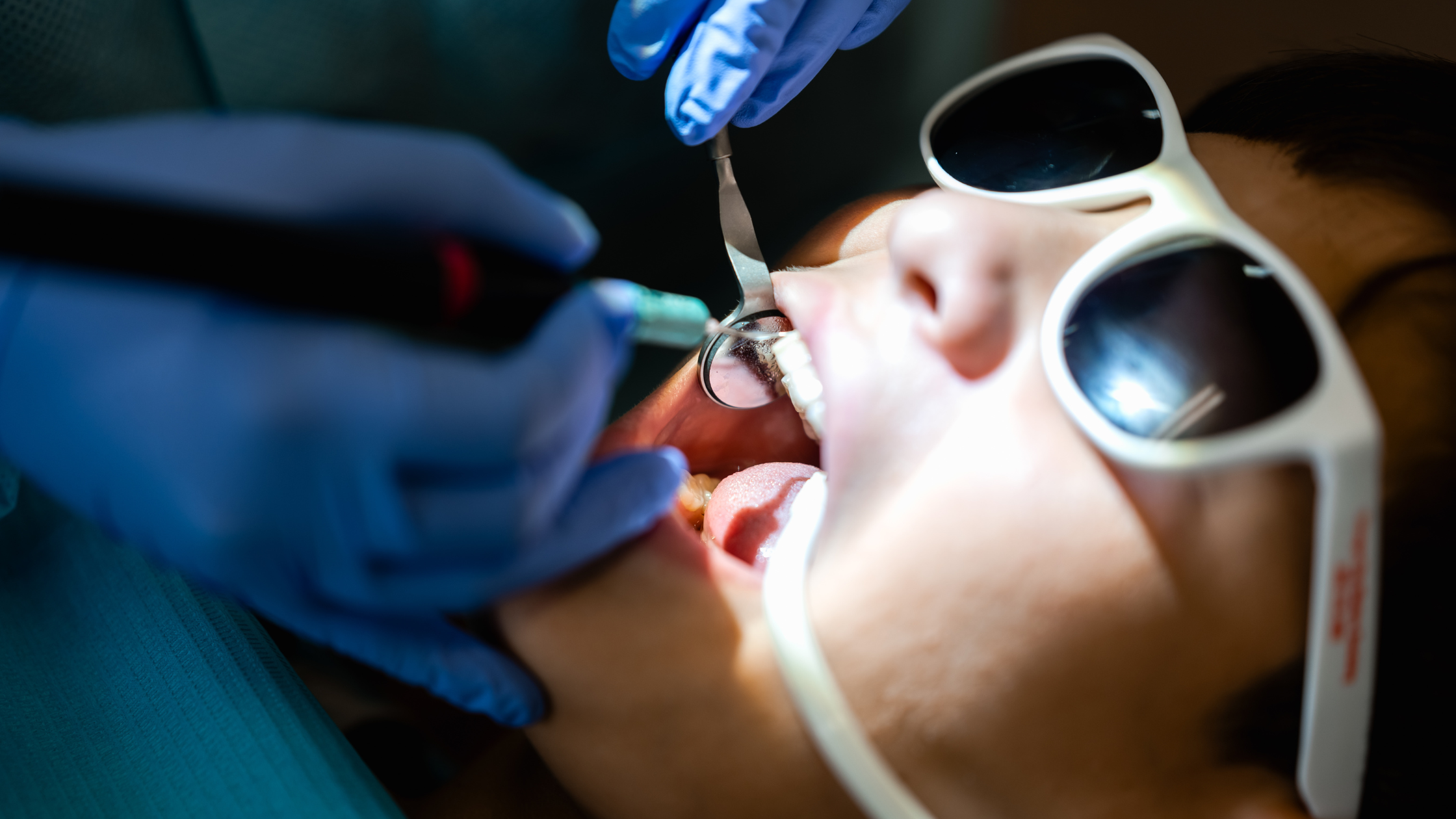 What is the Importance of Flossing?